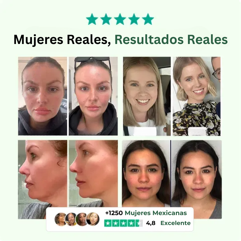 TEVORA Detox Drops™  - Reduce la Hinchazón Facial en Días